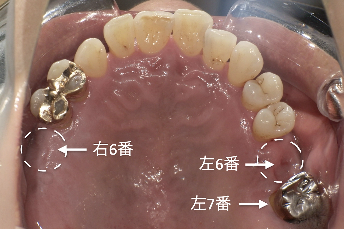 治療前