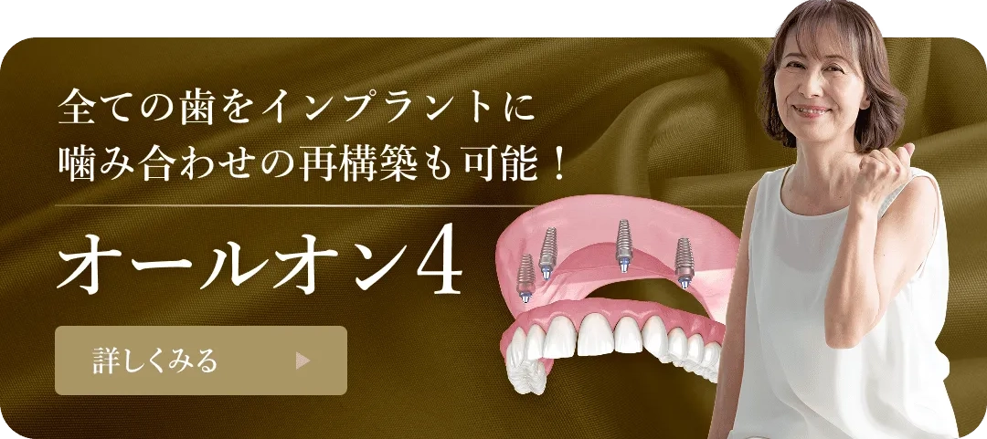 All-on-4インプラントのバナー