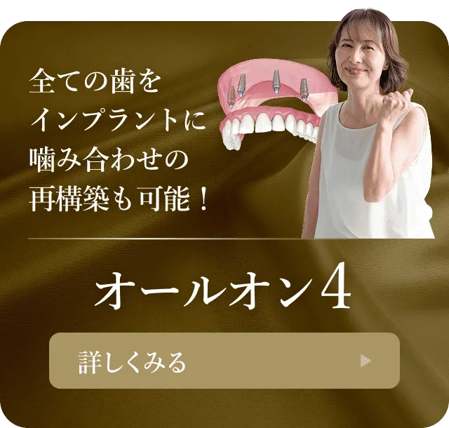 All-on-4インプラントのバナー