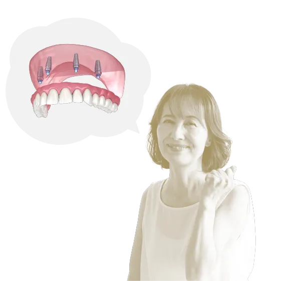 全ての歯をインプラントにするオールオン4